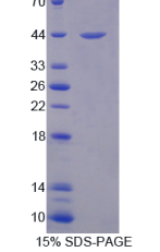 防御素α1(DEFα1)重组蛋白