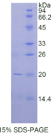 CD247分子(CD247)重组蛋白