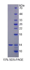 S100钙结合蛋白A12(S100A12)重组蛋白