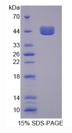 转钴胺素蛋白Ⅰ(TCN1)重组蛋白