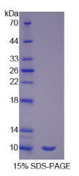 表面活性物质关联蛋白G(SPG)重组蛋白