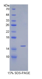 转化生长因子β1(TGFβ1)重组蛋白