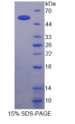 Sestrin 1蛋白(SESN1)重组蛋白