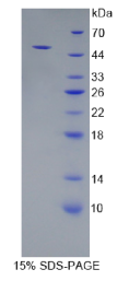 CD83分子(CD83)重组蛋白