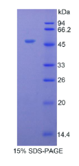 α1-酸性糖蛋白(α1AGP)重组蛋白