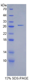 组织蛋白酶S(CTSS)重组蛋白