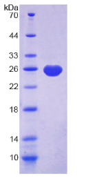 α1-酸性糖蛋白(α1AGP)重组蛋白