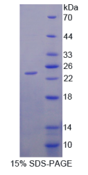 Glu/Asp丰富羧基端域Cbp/p300相互作用反式激活因子1(CITED1)重组蛋白