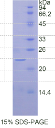 白介素1β(IL1β)重组蛋白