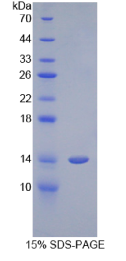 半胱氨酸蛋白酶抑制剂1(CST1)重组蛋白
