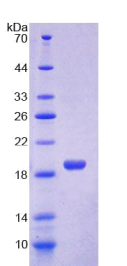 单核细胞趋化蛋白1(MCP1)重组蛋白
