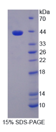 组蛋白脱乙酰基酶9(HDAC9)重组蛋白