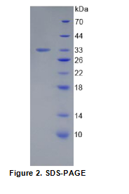 层粘连蛋白γ1(LAMγ1)重组蛋白