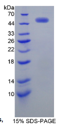 表皮生长因子受体2(EGFR2)重组蛋白