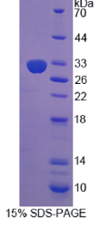 二肽基肽酶8(DPP8)重组蛋白