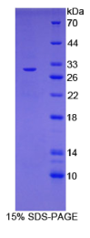 白介素27受体α(IL27Rα)重组蛋白