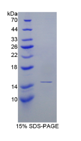 补体因子B(CFB)重组蛋白