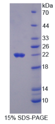 癌/睾丸抗原1B(CTAG1B)重组蛋白