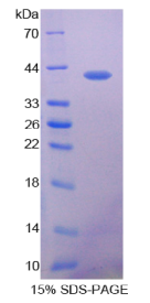 VEGF共调节趋化因子1(VCC1)重组蛋白