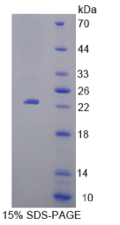 T-细胞激活连接蛋白家族成员2(LAT2)重组蛋白