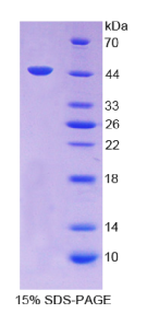 转化生长因子β1(TGFβ1)重组蛋白