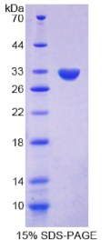 α-胞衬蛋白(SPTAN1)重组蛋白