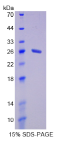 棕榈酰化膜蛋白6(MPP6)重组蛋白