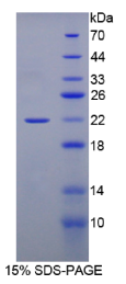 Gremlin 1蛋白(GREM1)重组蛋白
