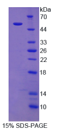 粘蛋白20(MUC20)重组蛋白