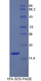 再生胰岛衍生蛋白3α(REG3α)重组蛋白