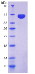 半乳糖凝集素4(GAL4)重组蛋白