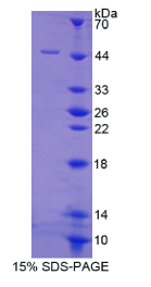 蛋白磷酸酶3调节因子亚基1(PPP3R1)重组蛋白
