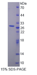 催乳素受体(PRLR)重组蛋白