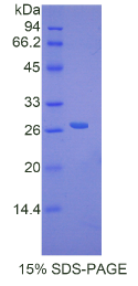 DNA修复蛋白RAD50(RAD50)重组蛋白