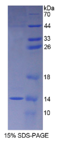 S100钙结合蛋白A8(S100A8)重组蛋白