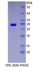 侧支发芽因子同源物3(SPRY3)重组蛋白