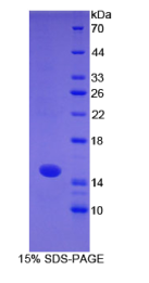 S100钙结合蛋白A7(S100A7)重组蛋白