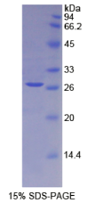 白介素2受体α(IL2Rα)重组蛋白