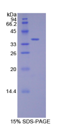 防御素β2(DEFβ2)重组蛋白