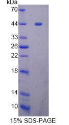 GDP解离抑制因子1(GDI1)重组蛋白