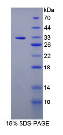 早期生长应答因子2(EGR2)重组蛋白