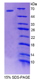 β-位淀粉样前体蛋白裂解酶1(βACE1)重组蛋白