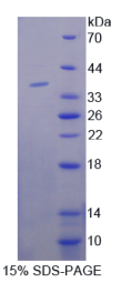 张力蛋白3(TNS3)重组蛋白