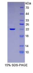 白介素1β(IL1β)重组蛋白