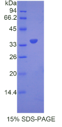 Slit同源物1(Slit1)重组蛋白