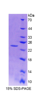 组织蛋白酶B(CTSB)重组蛋白