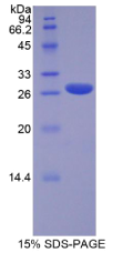 Runt相关转录因子2(RUNX2)重组蛋白