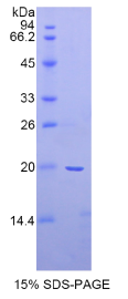 α2-纤溶酶抑制因子(α2PI)重组蛋白