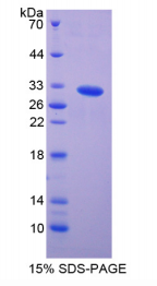 p21蛋白激活激酶2(PAK2)重组蛋白