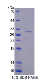 蛋白酶体亚基α5(PSMα5)重组蛋白